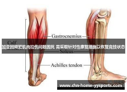 加亚因频繁肌肉拉伤问题困扰 需采取针对性康复措施以恢复竞技状态 加亚因频繁肌肉拉伤问题困扰 需采取针对性康复措施以恢复竞技状态
